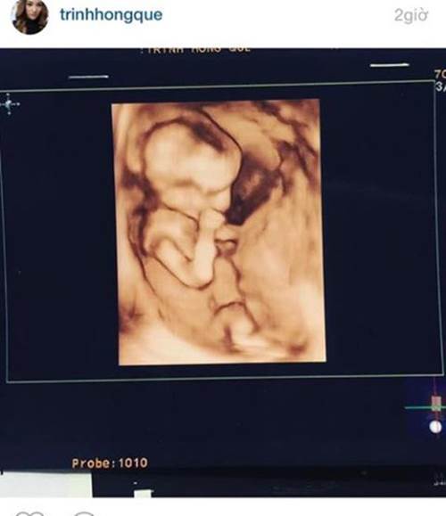 Chân dài bị đại gia bỏ khi mang bầu, sau sinh quyến rũ hết nấc, được trai đẹp để ý-1