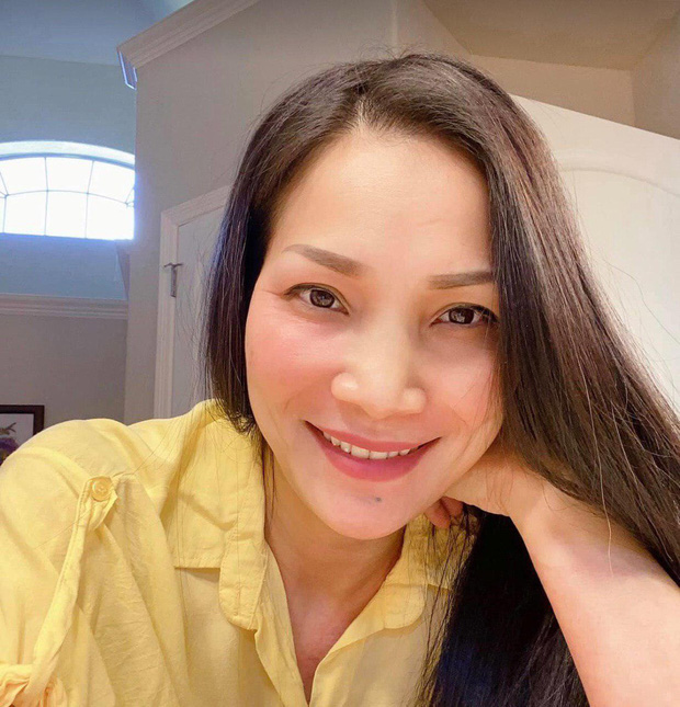 Nhan sắc của Hồng Ngọc sau hơn 1 tháng bỏng nặng: Gương mặt hồng hào, rạng rỡ nhưng vẫn còn thương tích khó lành-3