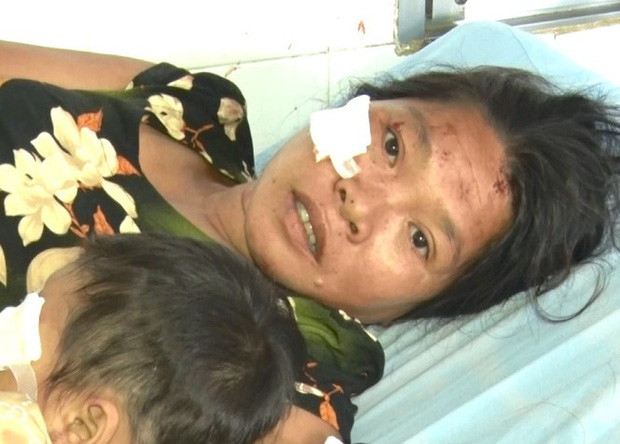 Lời kể hãi hùng của người sống sót trong vụ tai nạn thảm khốc ở Kon Tum-2