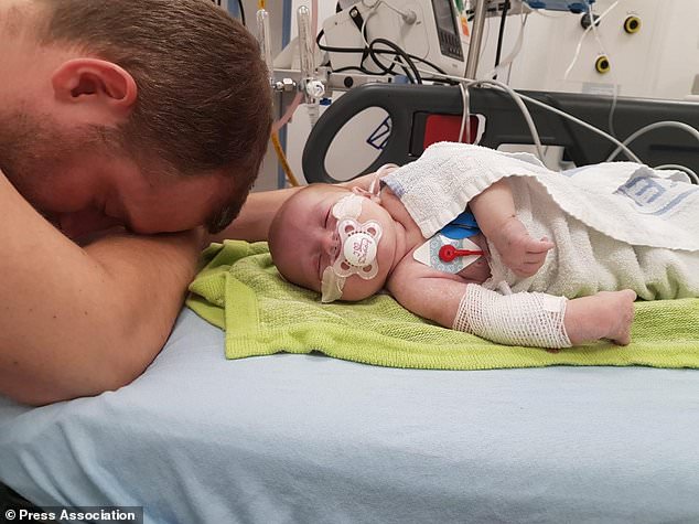 Nhịp tim tăng lên 320 lần/phút, bé sơ sinh được bác sĩ cấp cứu bằng cách nhúng đầu vào xô nước đá-1