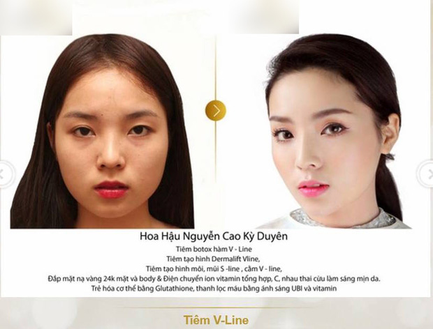 1001 nghi vấn chưa được làm sáng tỏ của dàn Hoa hậu, Á hậu Việt: Người bị tố nói dối chuyện làm đẹp, kẻ lại bị mỉa mai vì danh xưng rich kid ảo?-2