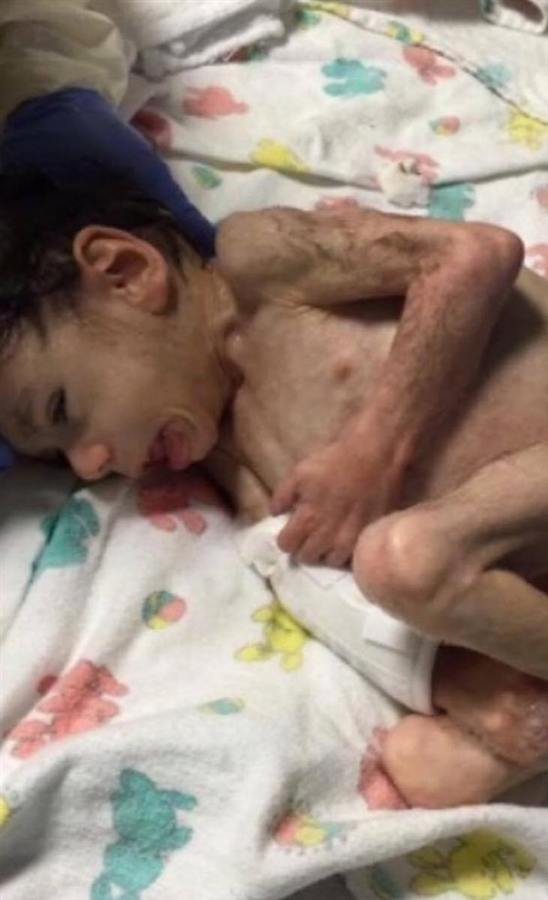 Cặp đôi sốc khi thấy con trai nuôi bệnh tật và suy dinh dưỡng nặng, bác sĩ bảo không có hy vọng nhưng 4 năm sau ai cũng ngỡ ngàng-3