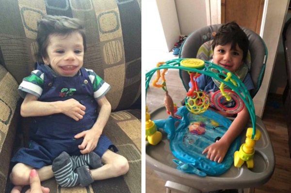 Cặp đôi sốc khi thấy con trai nuôi bệnh tật và suy dinh dưỡng nặng, bác sĩ bảo không có hy vọng nhưng 4 năm sau ai cũng ngỡ ngàng-4