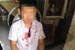 Vụ người đàn ông đấm hộc máu mồm bé trai lớp 1 để trả thù thay con: Mẹ nạn nhân lên tiếng-2
