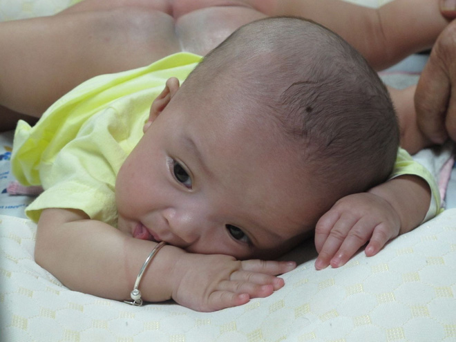 Sẵn sàng cho ca mổ tách dính 2 bé gái dùng chung một bỉm tại BV Nhi Đồng TP.HCM-7