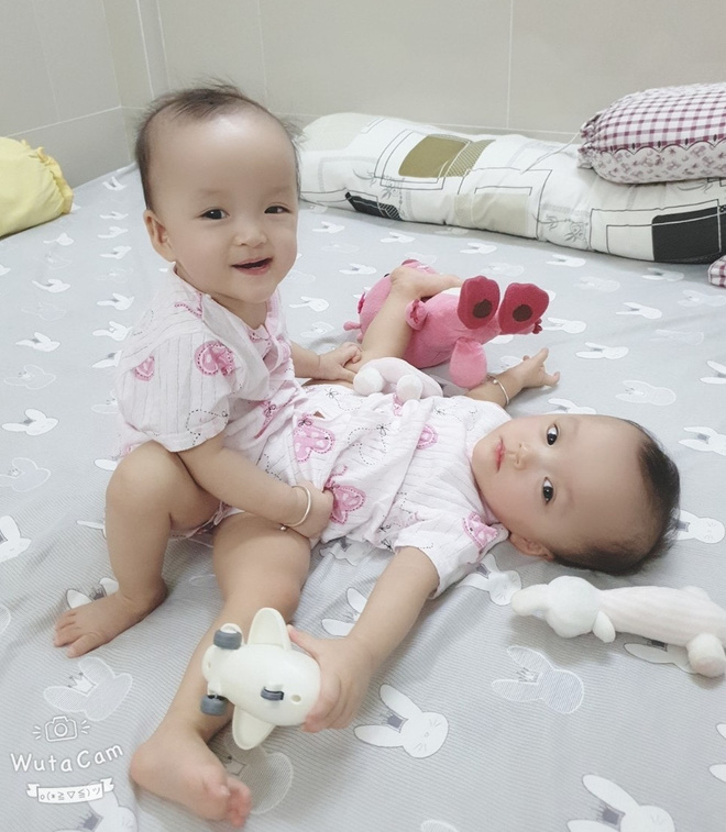 Sẵn sàng cho ca mổ tách dính 2 bé gái dùng chung một bỉm tại BV Nhi Đồng TP.HCM-8