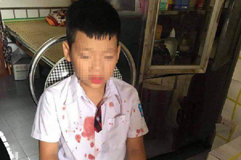 Bé trai lớp 1 bị người đàn ông hành hung để trả thù” đang hoảng loạn, không muốn đến trường học-1