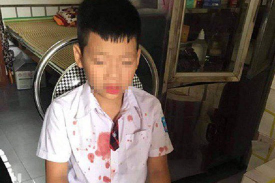 Bé trai lớp 1 bị người đàn ông hành hung để “trả thù” đang hoảng loạn, không muốn đến trường học