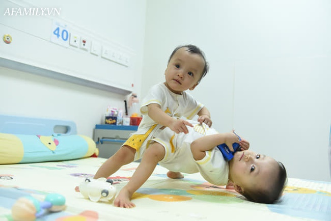 Mẹ 2 bé gái song sinh dính nhau nghẹn ngào mong con bình an trước khi bước vào ca mổ sinh tử-3