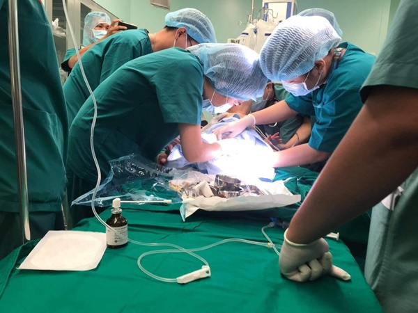 Cận cảnh ca đại phẫu thuật tách cặp Trúc Nhi - Diệu Nhi-5