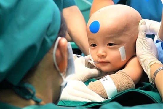 Nhiệm vụ của 100 y bác sĩ trong ca đại phẫu tách song sinh dính liền
