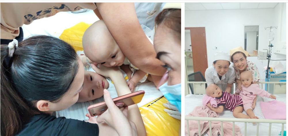 Đang tiến hành phẫu thuật tách dính 2 bé gái song sinh: Bố mẹ con đã khóc, mọi người đều mong các con được bình an-1