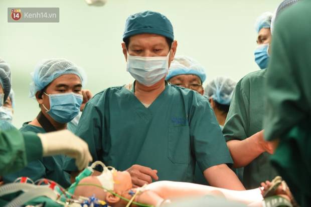Đang tiến hành phẫu thuật tách dính 2 bé gái song sinh: Bố mẹ con đã khóc, mọi người đều mong các con được bình an-6
