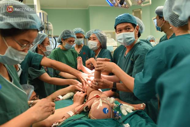 Đang tiến hành phẫu thuật tách dính 2 bé gái song sinh: Bố mẹ con đã khóc, mọi người đều mong các con được bình an-8
