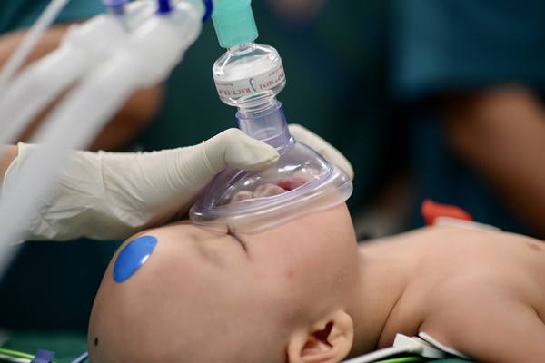 Tách thành công cặp song sinh dính liền-11