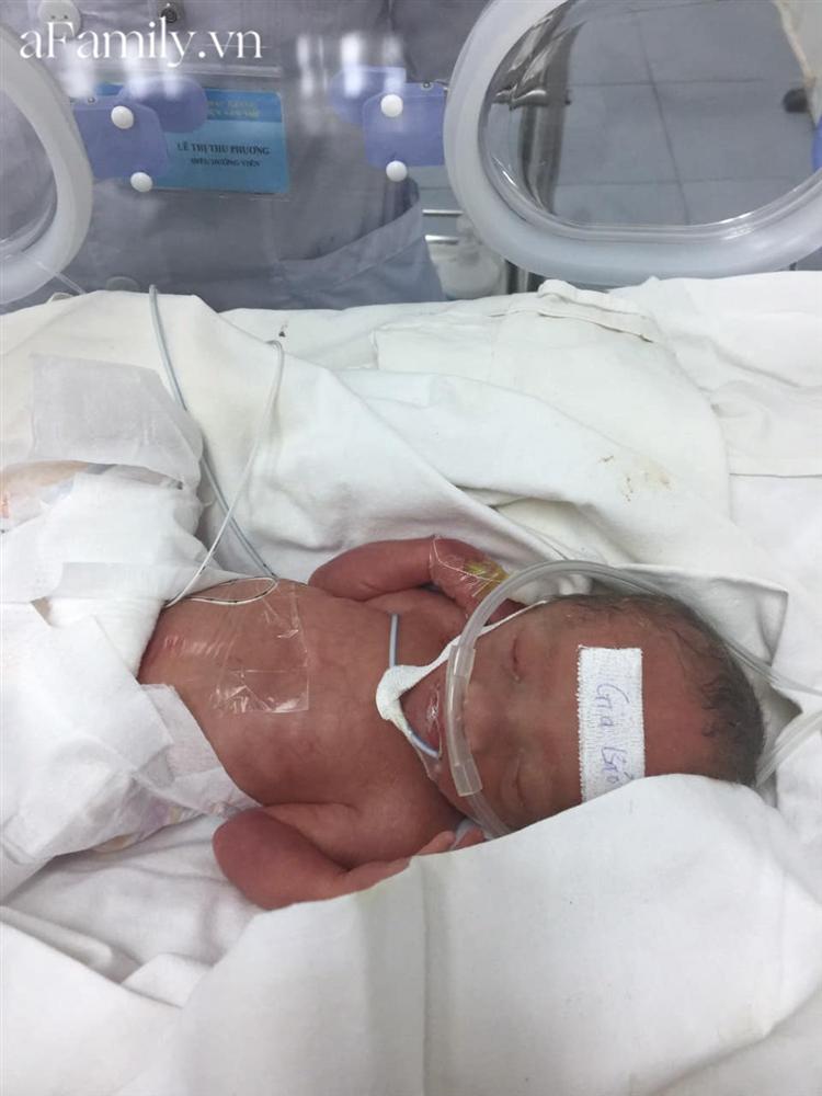 Mẹ Bắc Giang sinh non con chỉ nặng 1,2kg, đêm không dám ngủ vì sợ con ngưng thở, 5 tháng sau nhìn bé ai cũng bất ngờ-3