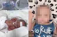 Mẹ Bắc Giang sinh non con chỉ nặng 1,2kg, đêm không dám ngủ vì sợ con ngưng thở, 5 tháng sau nhìn bé ai cũng bất ngờ