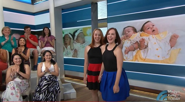 2 con gái sinh đôi dính liền, cha mẹ mất 7 tháng mới quyết định tách rời con, 17 năm sau ai cũng mãn nguyện khi thấy nụ cười của các em-10