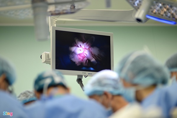 Tách thành công cặp song sinh dính liền-3