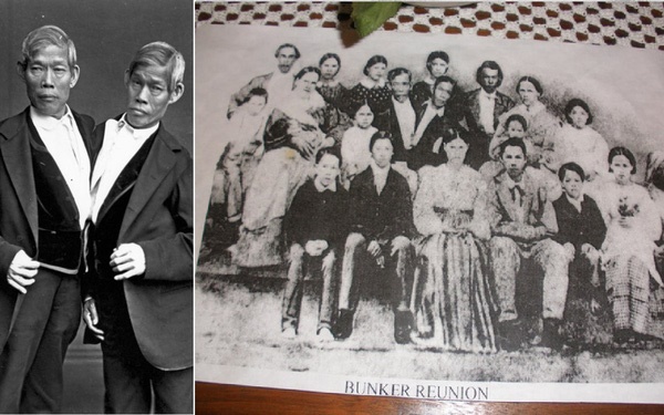 Những ca song sinh dính liền dù không phẫu thuật tách vẫn sống sót kì diệu, có cặp vẫn kết hôn và sinh tổng cộng 21 người con-3