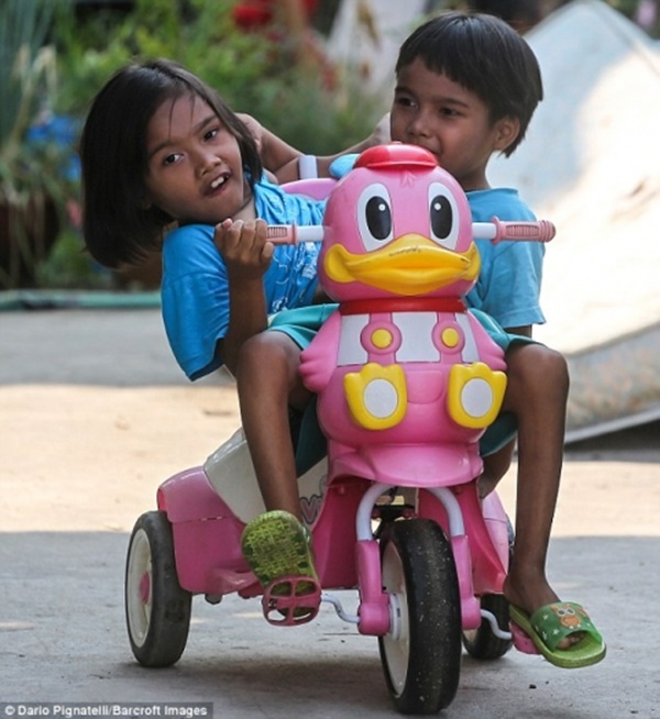 Những ca song sinh dính liền dù không phẫu thuật tách vẫn sống sót kì diệu, có cặp vẫn kết hôn và sinh tổng cộng 21 người con-11