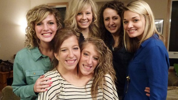 Những ca song sinh dính liền dù không phẫu thuật tách vẫn sống sót kì diệu, có cặp vẫn kết hôn và sinh tổng cộng 21 người con-9