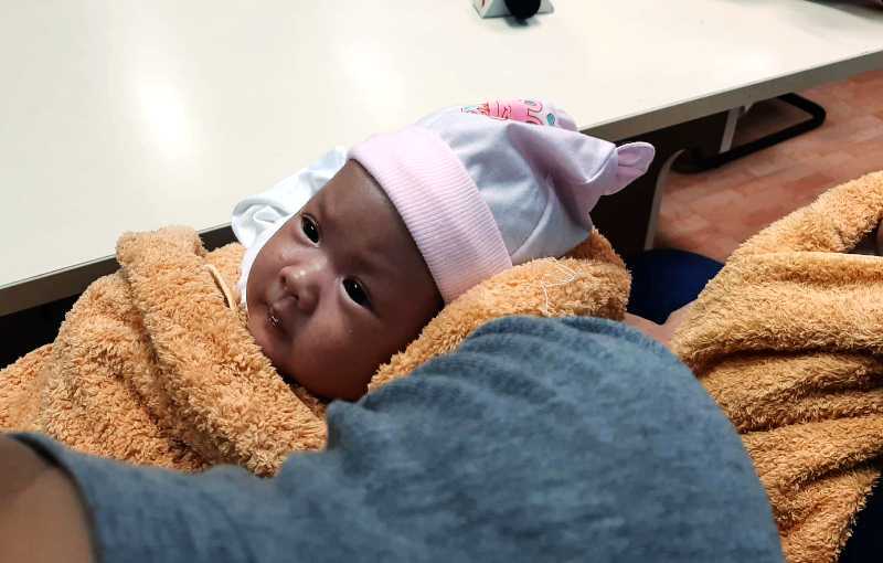 Loạt ảnh trước và sau mổ tách của các cặp song sinh dính liền nhau: Theo dõi kết quả phẫu thuật chắc chắn ai cũng phải thốt lên rằng quá kỳ diệu!-3