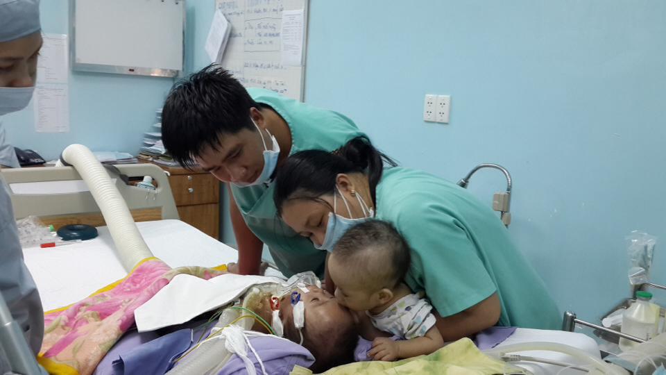 Loạt ảnh trước và sau mổ tách của các cặp song sinh dính liền nhau: Theo dõi kết quả phẫu thuật chắc chắn ai cũng phải thốt lên rằng quá kỳ diệu!-6