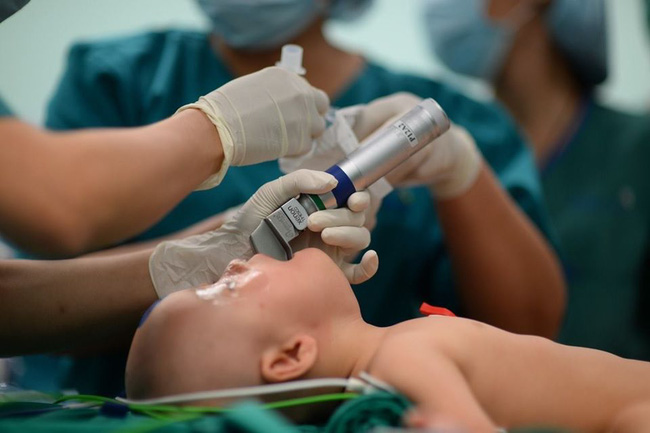 Video cận cảnh quá trình gây mê phẫu thuật tách cặp song sinh dính liền khiến người xem xúc động-3