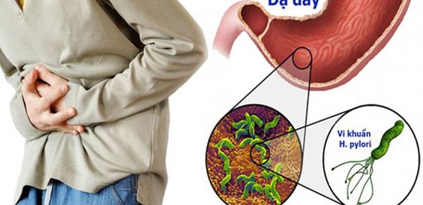 Cô gái 20 tuổi bị ung thư dạ dày vì thói quen mà rất nhiều người cũng mắc phải trong khi ăn-3