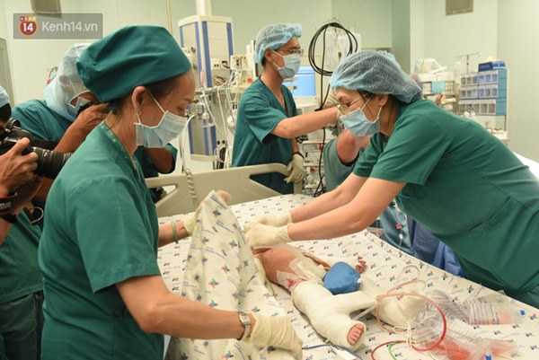 ẢNH: Khoảnh khắc xúc động trong suốt 12 tiếng phẫu thuật giúp Trúc Nhi - Diệu Nhi có được hình hài nguyên vẹn-19