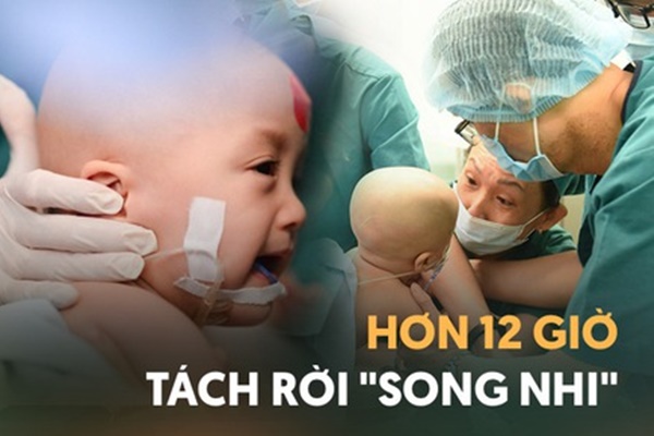 Cha mẹ cặp song sinh được tách rời Trúc Nhi  Diệu Nhi Nghẹn lại vì 2 con
