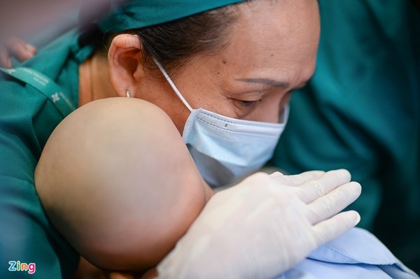 Cuộc đại phẫu đặc biệt của gần 100 bác sĩ tách song sinh dính liền-8