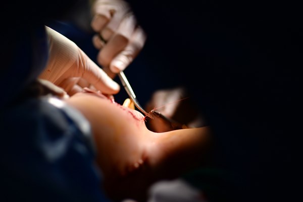 Cuộc đại phẫu đặc biệt của gần 100 bác sĩ tách song sinh dính liền-12