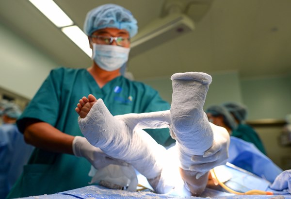 Cuộc đại phẫu đặc biệt của gần 100 bác sĩ tách song sinh dính liền-16