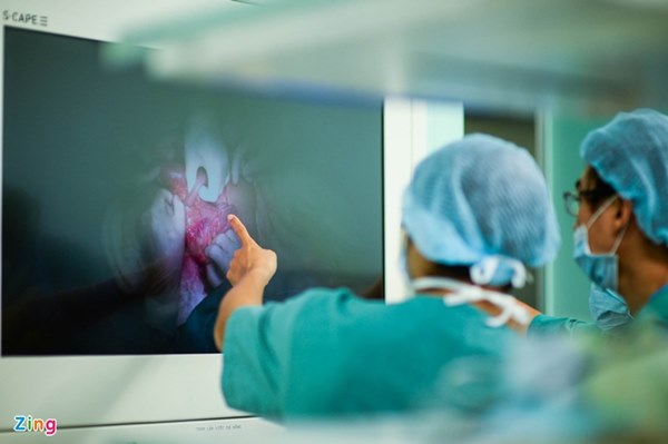 Cuộc đại phẫu đặc biệt của gần 100 bác sĩ tách song sinh dính liền-27