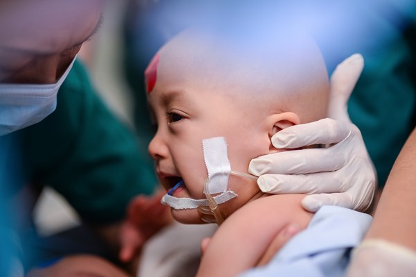 Cuộc đại phẫu đặc biệt của gần 100 bác sĩ tách song sinh dính liền-29