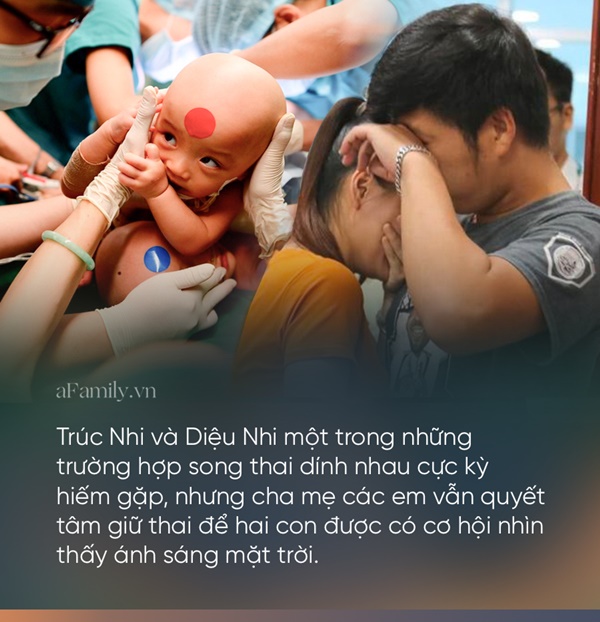 Sticker xanh - đỏ trên ngực áo ê-kíp phẫu thuật tách rời cặp song sinh dính liền và những kỳ tích làm từ trái tim-12