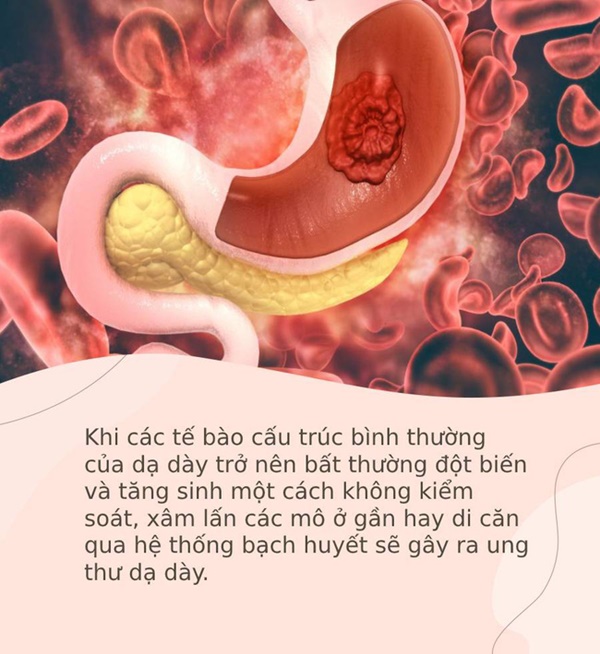 Hai căn bệnh cực kỳ phổ biến và rất dễ phát triển thành ung thư, bạn cần ngăn chặn ngay từ bây giờ-4