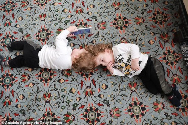 Cặp song sinh dính liền đầu, không nhìn thấy mặt nhau, tái sinh sau ca phẫu thuật tách rời-2