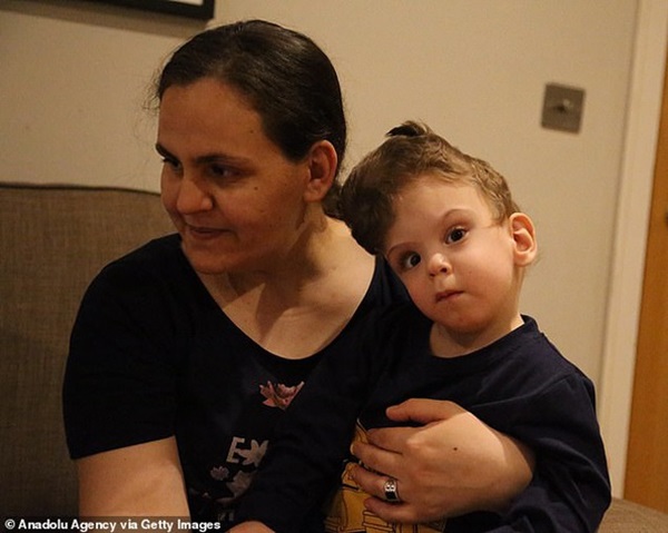 Cặp song sinh dính liền đầu, không nhìn thấy mặt nhau, tái sinh sau ca phẫu thuật tách rời-8