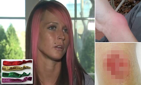 Chị em đừng bao giờ đeo dây chun buộc tóc ở cổ tay: Lý do thì có nhiều nhưng đây là 2 lý do ảnh hưởng trực tiếp đến tính mạng-2