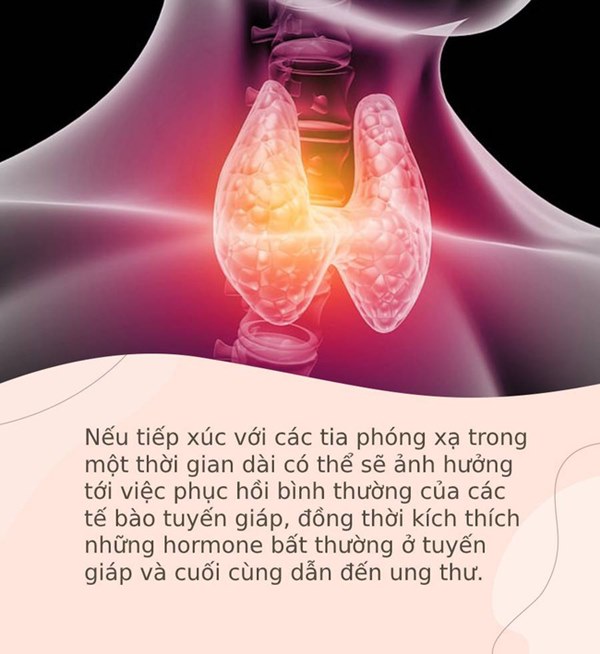 Đây là 4 kiểu người có nguy cơ cao mắc ung thư tuyến giáp nhất: Nếu cũng thuộc nhóm người này, bạn nên đi khám càng sớm càng tốt-3