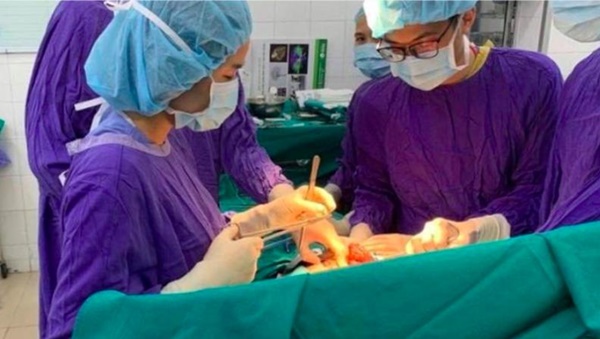 Tiết lộ bất ngờ về nguyên nhân ung thư gan, từ món ăn hàng triệu người Việt ưa thích-1