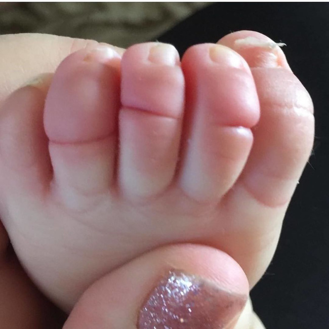 Thấy ngón chân của con đột nhiên bị sưng phồng, bà mẹ đưa con đi khám và sững sờ khi nghe bác sĩ nói nguyên nhân-1