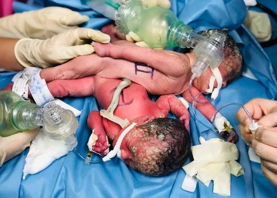 Mẹ hai bé song sinh Diệu Nhi - Trúc Nhi: Thế giới này có muôn vàn điều kì diệu và hai con là điều đặc biệt nhất với mẹ-2