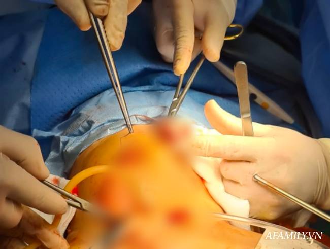 Bác sĩ ekip chỉnh hình trong ca tách song sinh Trúc Nhi - Diệu Nhi tiết lộ khoảnh khắc cuối cùng: Vừa bó bột xong là… muốn gục-3