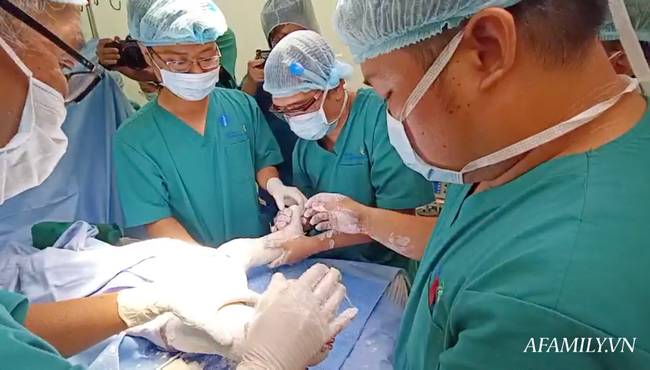 Bác sĩ ekip chỉnh hình trong ca tách song sinh Trúc Nhi - Diệu Nhi tiết lộ khoảnh khắc cuối cùng: Vừa bó bột xong là… muốn gục-6