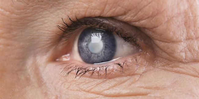 Căn bệnh khiến nữ MC xinh đẹp của VTV có thể bị mù cả 2 mắt: Nhiều người trẻ cũng có nguy cơ nếu thấy dấu hiệu này mà không nhanh chóng đi khám-5