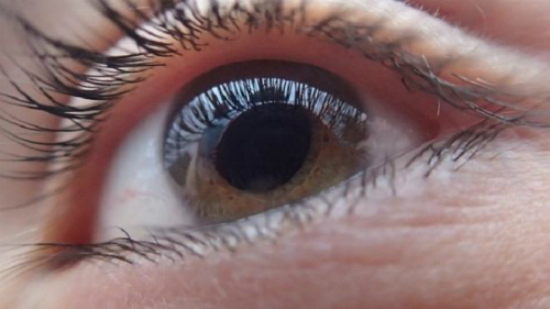 Căn bệnh khiến nữ MC xinh đẹp của VTV có thể bị mù cả 2 mắt: Nhiều người trẻ cũng có nguy cơ nếu thấy dấu hiệu này mà không nhanh chóng đi khám-6